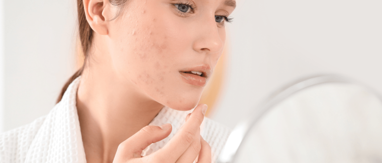 Are Ceramides Peptides