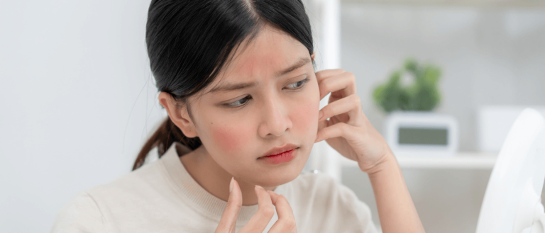 Can Peptides Cause Acne? 3 Can Peptides Cause Acne