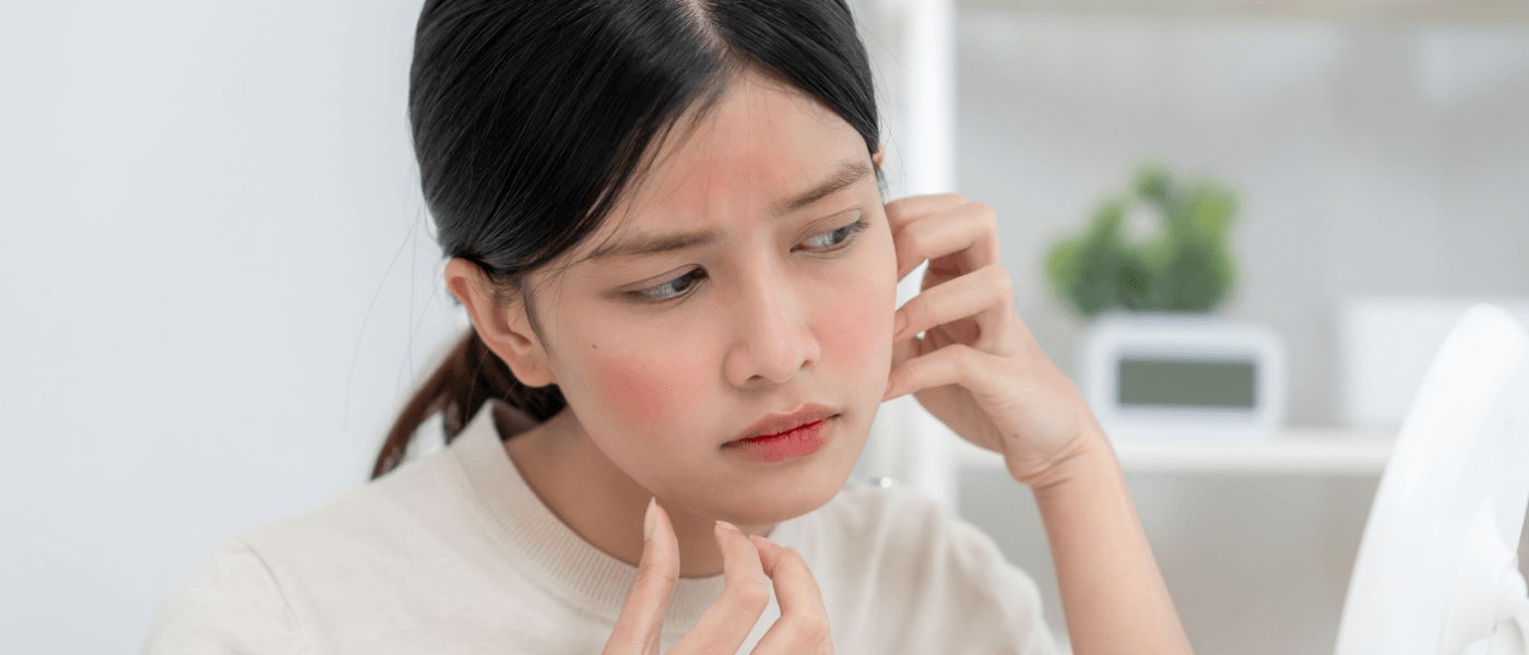 Can Peptides Cause Acne
